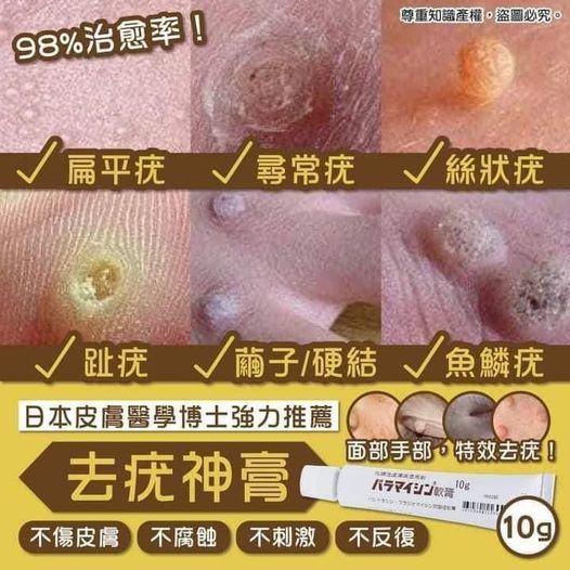 🇯🇵日本皮膚醫學博士強力推薦 去疣神膏 10g